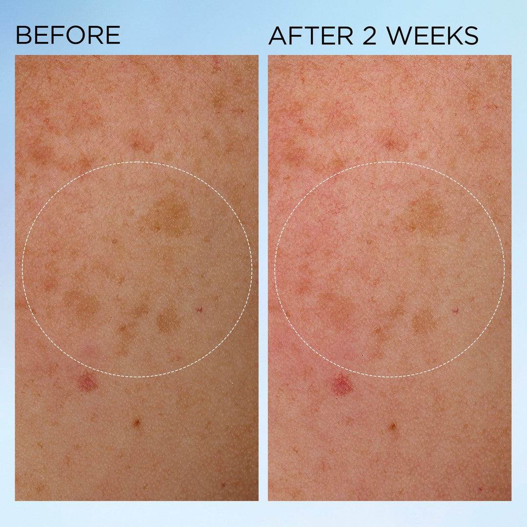 Elizabeth Arden UK Visible Brightening Clearly Radiant Bounce Cream Before & After 2 weeks results