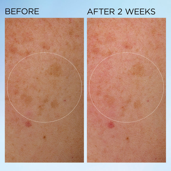 Elizabeth Arden UK Visible Brightening Clearly Radiant Bounce Cream Before & After 2 weeks results