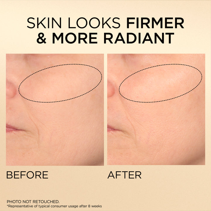 Before-and-after skincare comparison graphic showing a close-up of a person's cheek with a dotted oval highlighting skin texture and wrinkles. Large text reads 'SKIN LOOKS FIRMER & MORE RADIANT' at the top and 'BEFORE' and 'AFTER' below the two photos.