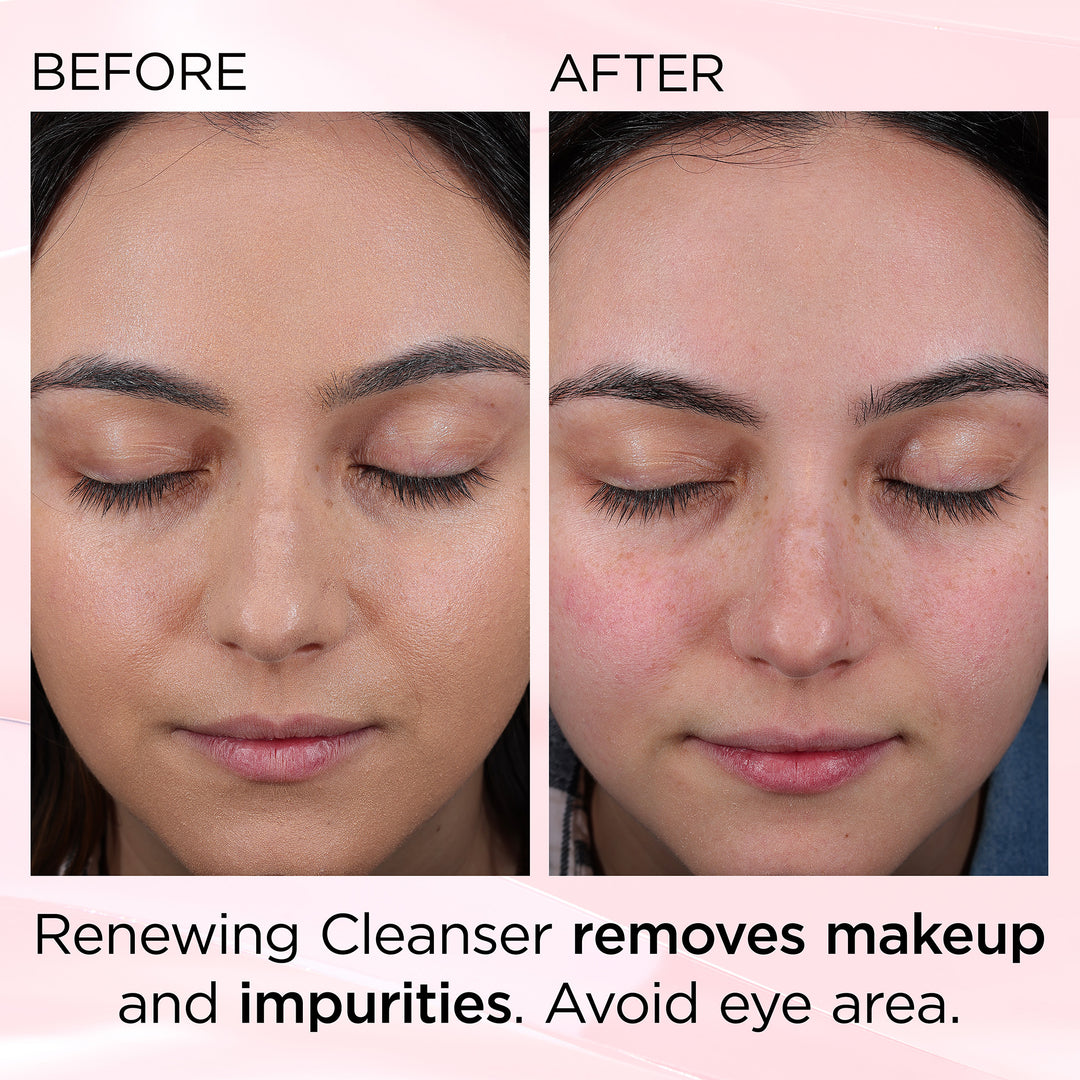 Ceramide Skin Renewing Cleanser