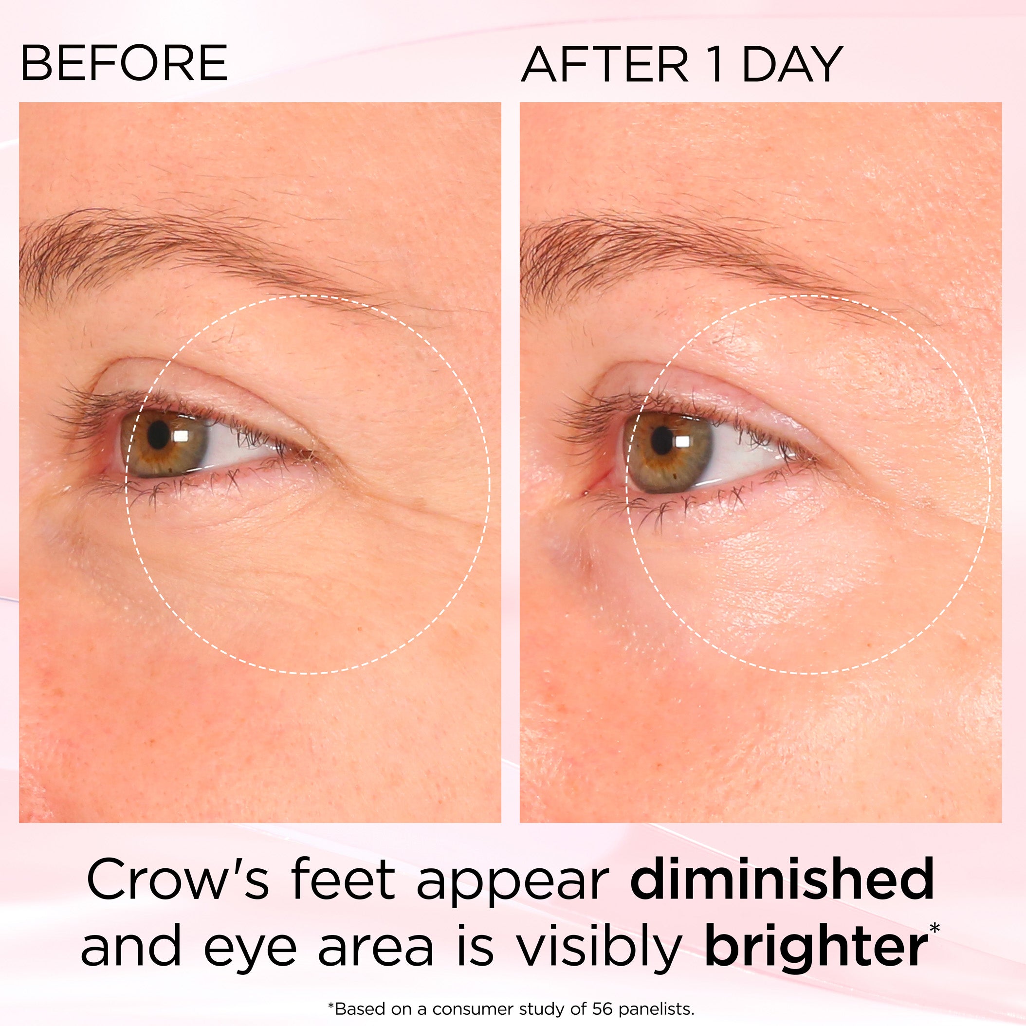 Retinol + HPR Ceramide Rapid Skin Renewing Eye Cream | Elizabeth