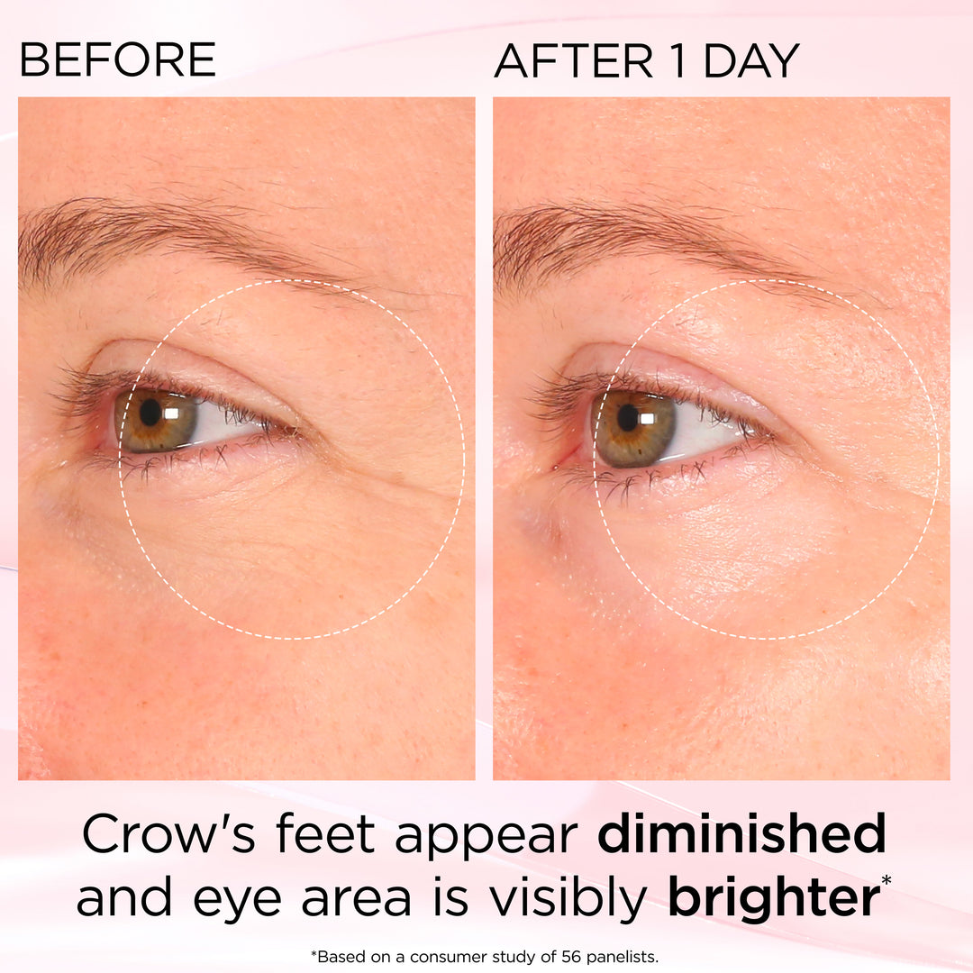 Retinol + HPR Ceramide Rapid Skin Renewing Eye Cream