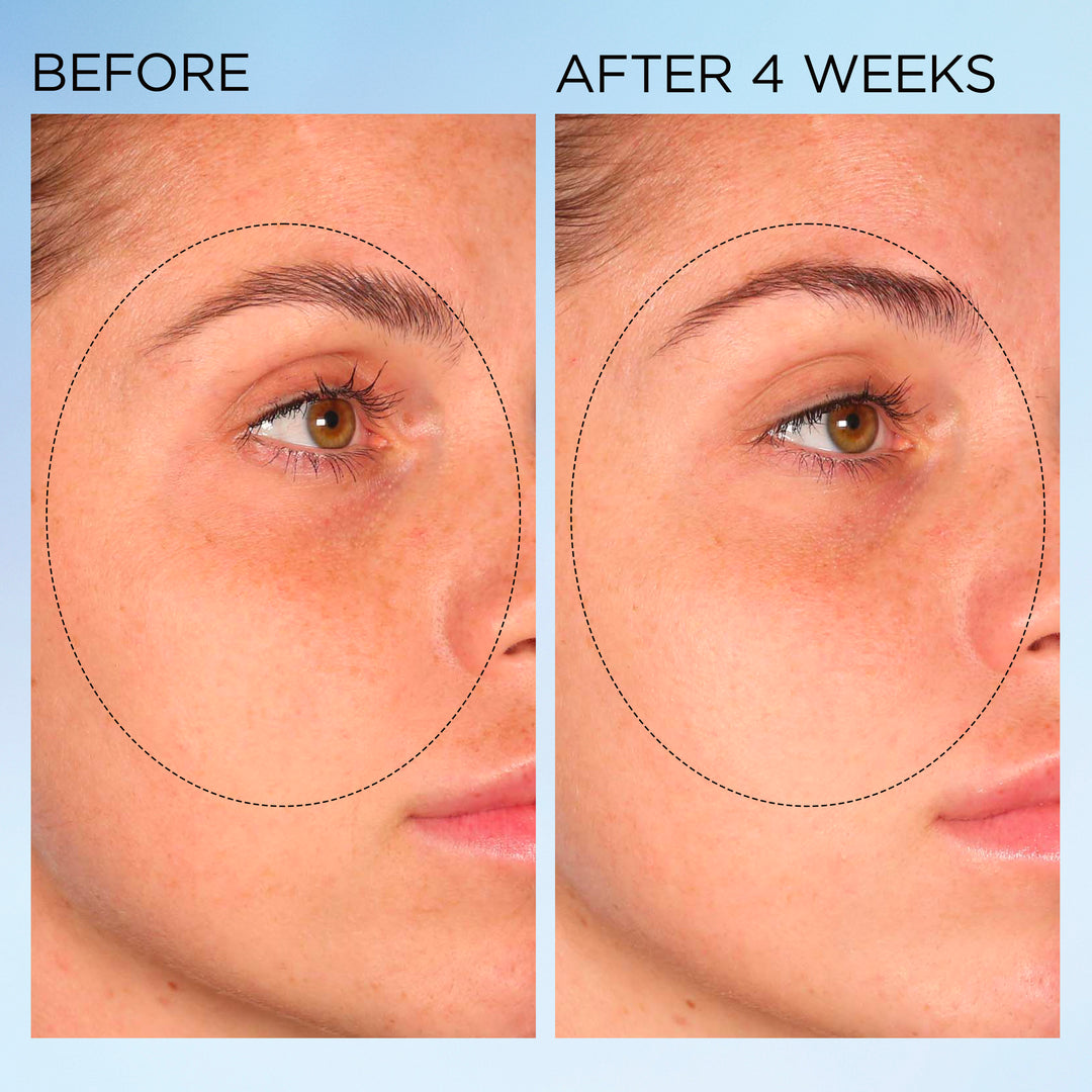 Elizabeth Arden UK Visible Brightening Clearly Radiant Spot Correcting Serum Capsules before & after 4 weeks results