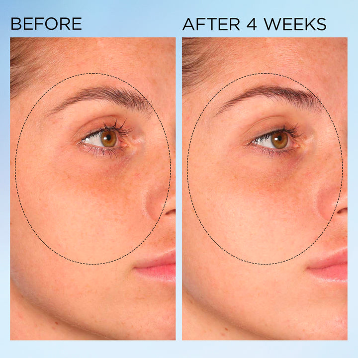 Elizabeth Arden UK Visible Brightening Clearly Radiant Spot Correcting Serum Capsules before & after 4 weeks results