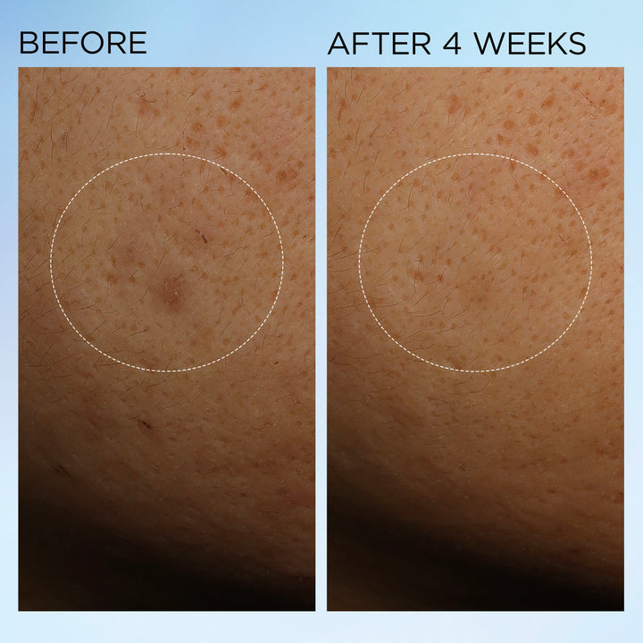 Elizabeth Arden UK Visible Brightening Clearly Radiant Bounce Cream Before & After 4 weeks results