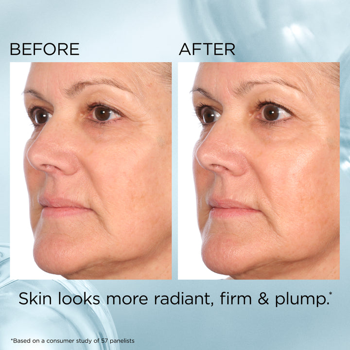 Hyaluronic Acid + Peptides Ceramide Hydra-Plumping Water Cream before & after results
