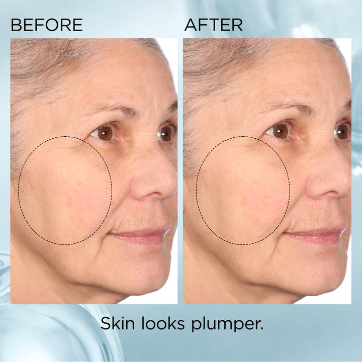 Hyaluronic Acid + Peptides Ceramide Hydra-Plumping Water Cream before & after results