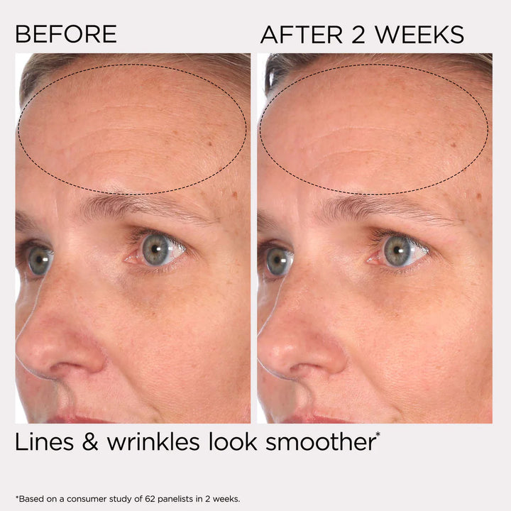 Before-and-after comparison showing a close-up of a woman's forehead and eye area, with text reading 'BEFORE' and 'AFTER 2 WEEKS' and 'Lines & wrinkles look smoother'.