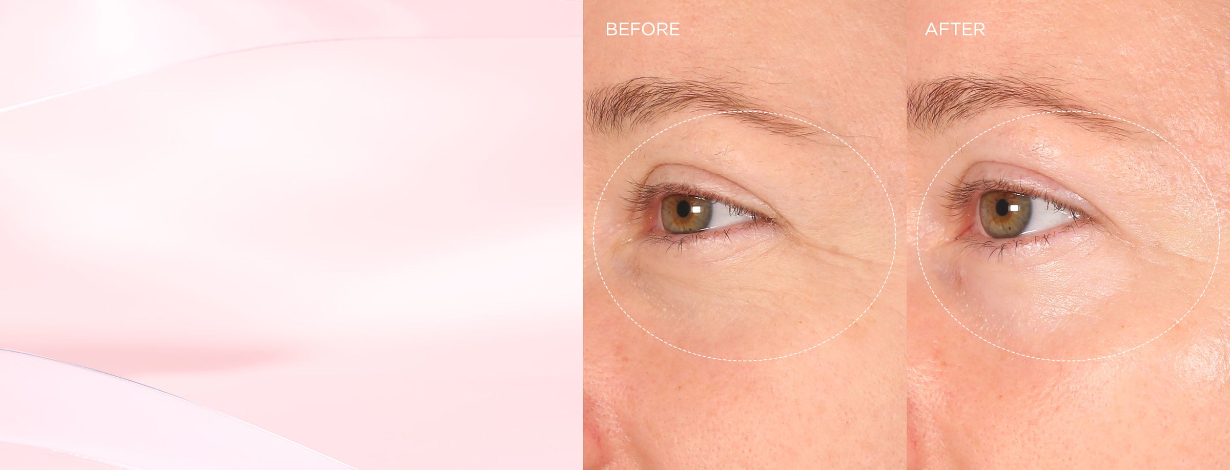 womens face close upof lashes before and after