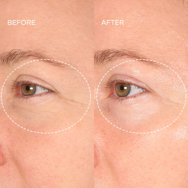 womens face close upof lashes before and after