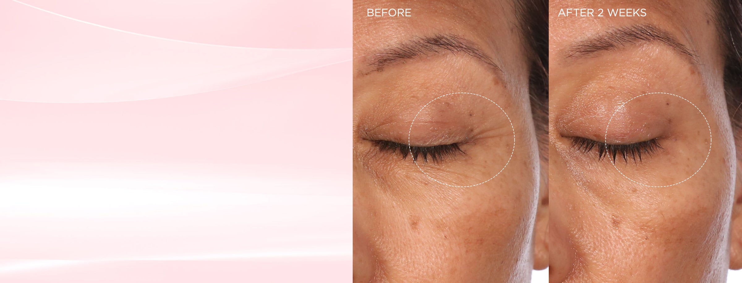 womens face close up of lashes before and after